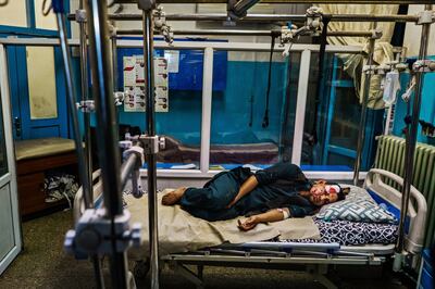 A wounded patient lies in the recovery unit at Wazir Akbar Khan Hospital in Kabul after a suicide bomber from the terrorist group ISIS-K struck the Afghan capital's airport in August, 2021. EPA