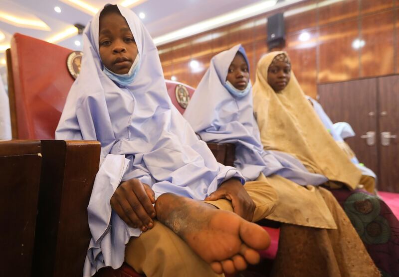 A girl who was kidnapped from a boarding school in the northwest Nigerian state of Zamfara, shows her injured foot after her release in Zamfara, Nigeria. Reuters