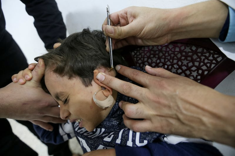 A hearing impaired Palestinian boy receives bee-sting treatment in Gaza City