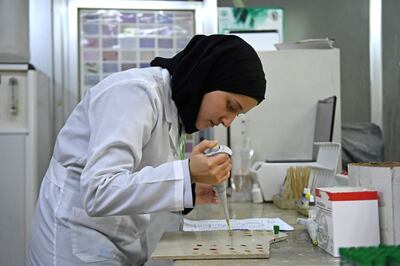 A lab technician works on samples to test for cholera, at a hospital in Syria's northern city of Aleppo. AFP 