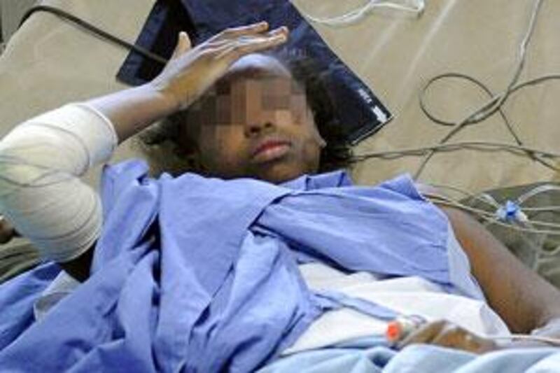 Bahia Bakari, 13, lies in her bed at the hospital after she survived the Yemenia airliner crash off the Comoros islands.