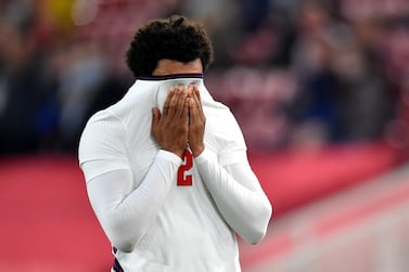 epa09243994 England's Trent Alexander-Arnold reacts after being injured during the International Friendly soccer match between England and Austria in Middlesbrough, Britain, 02 June 2021. EPA/Peter Powell / POOL