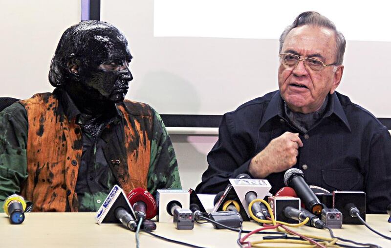 Sudheendra Kulkarni, appears at a news conference in Mumbai blackened by ink after he was attacked by right-wing Hindu nationalists. AFP Photo