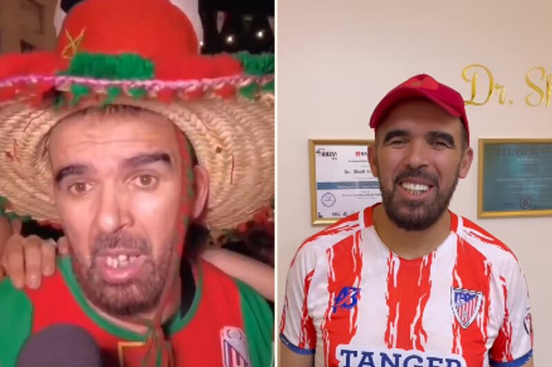 Moroccan football fan Mohammed Al Sharafi, 55, has received dentures less than two weeks after he was bullied by online trolls who made fun of his crooked teeth when they spotted him on television as he encouraged his national team. All photos: Dr Shadi Al Shaikh / Twitter