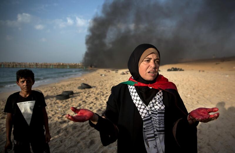 A Palestinian woman with blood in her hands from a wounded protester, gestures in front of the cameras during a protest on the beach at the border with Israel near Beit Lahiya, northern Gaza Strip. AP Photo