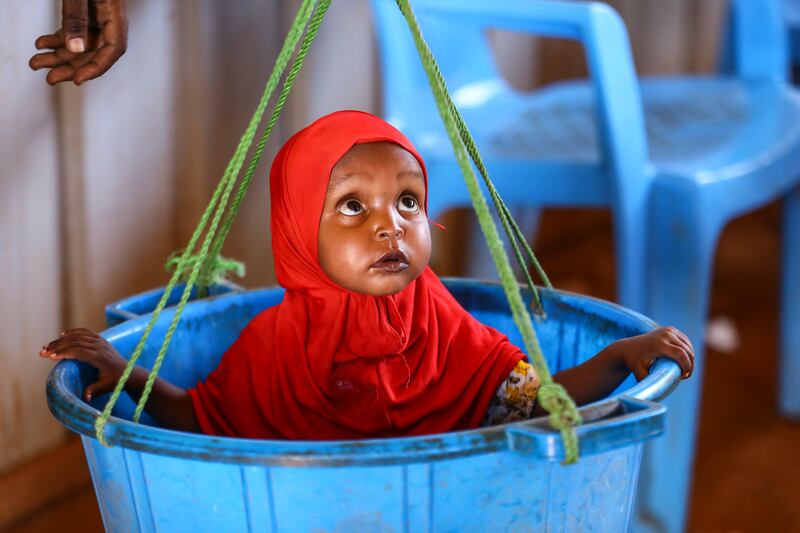 A baby is weighed at a camp for internally displaced people in Jubaland state, Somalia. More than a quarter of the country's population have been displaced amid extremist violence. EPA 