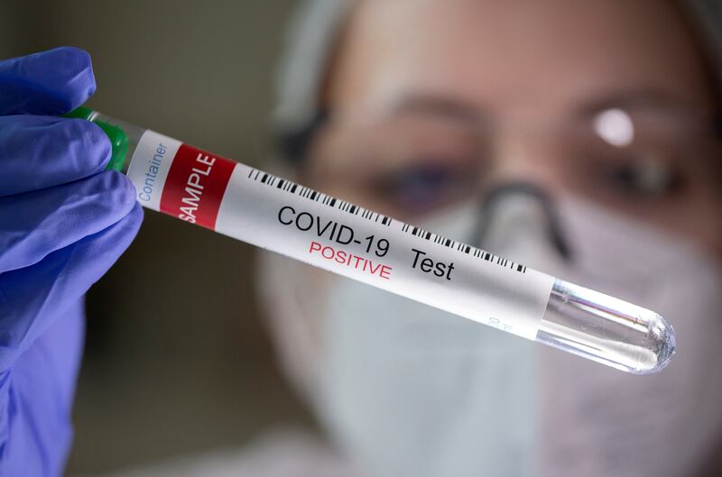 A large study of long Covid in the UK found one in 20 people diagnosed with the infection were still reporting symptoms 12 months later. Reuters