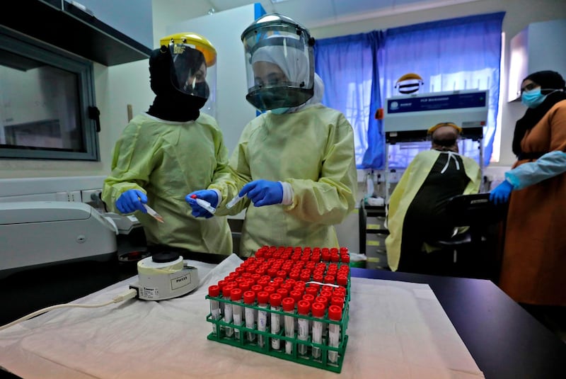 Medical workers handle test samples at a Palestinian Health Ministry testing lab for COVID-19 coronavirus disease in the West Bank city of Ramallah on February 2, 2021.  / AFP / ABBAS MOMANI
