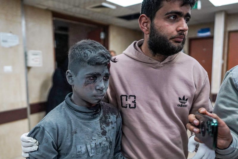 A wounded boy arrives at Al Aqsa Martyrs Hospital in Deir Al Balah on Tuesday, after an Israeli bombardment of Nuseirat refugee camp in central Gaza. AFP