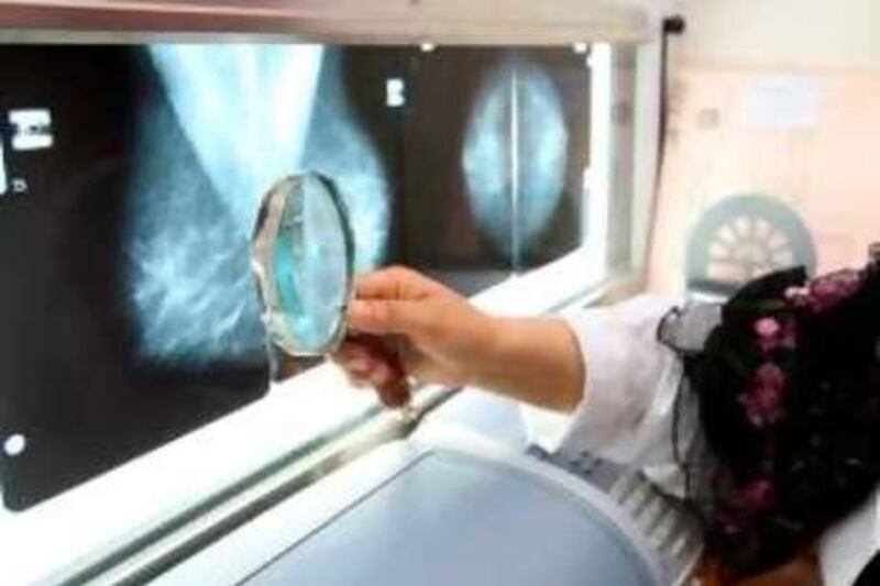 March 9, 2008 ABU DHABI, UAE
Dr. Jalaa Taher looks at chest x-rays at the National Health Screening Program for Women and Children, part of the Ministry of Health. She and several other doctors are part of a global initiative to promote breast cancer awareness. PHOTO: Nicole Hill / The Nation *** Local Caption *** na10cancer1.jpg