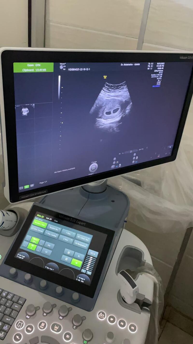 An ultrasound revealing two heartbeats.