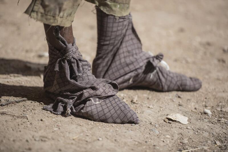 A frankinsence tapper wears cloth wrapped on his feet to keep sticky resin from his skin and shoes near Gudmo, Somaliland. Besides its use as incense, frankincense gum is distilled into oil for use in perfumes, skin lotions, medicine and chewing gum.