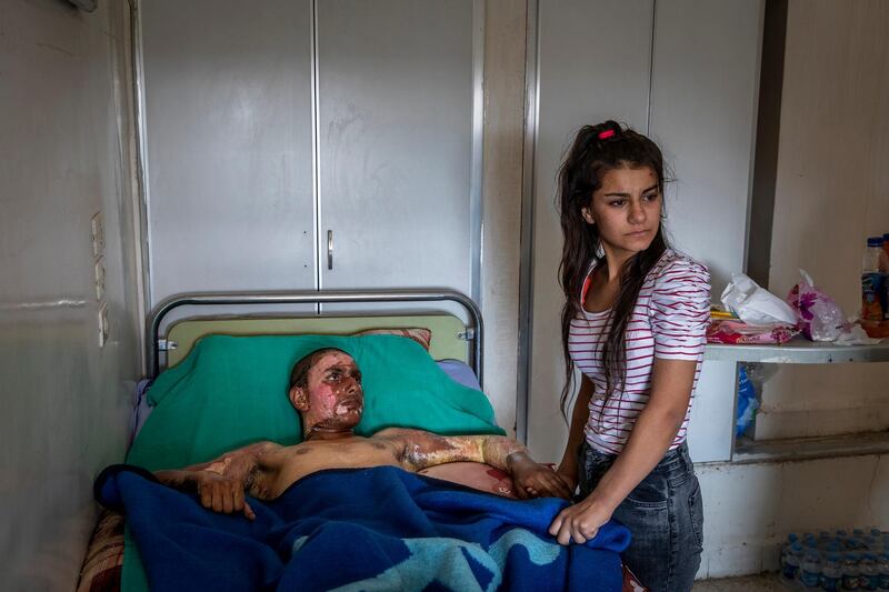 A photo by Ivor Prickett showing Ahmed Ibrahim, 18, an SDF fighter badly burned in conflict with Turkish forces, being visited by his girlfriend at a hospital in Al Hasakah, on October 20, 2019. Ivor Prickett / The New York Times