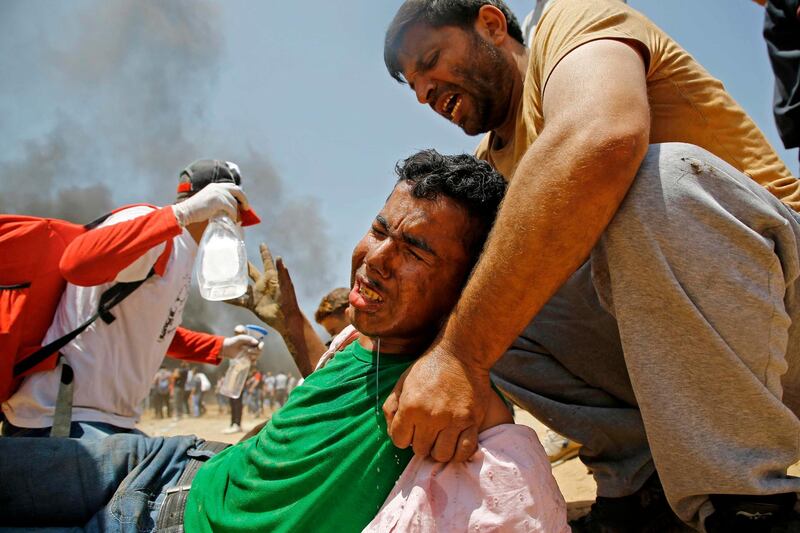Hundreds of protesters have been wounded in Monday's demonstrations. Mohammed Abed  / AFP Photo