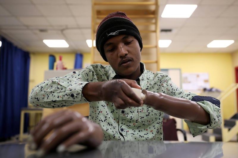 War-wounded Abdullah Ayed, 21 year-old man from Yemen, tries his 3D-printed prosthetic limb at the MSF-run hospital in Amman, Jordan. Reuters