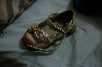 The shoe of a Syrian girl who was injured in shelling on the town of Misraba is seen at a make-shift hospital in the besieged rebel-held town of Douma, on the outskirts of the capital Damascus on early January 4, 2018.
At least 23 civilians were killed in the Syrian opposition redoubt of East Ghouta, near Damascus, with the majority of victims perishing in Russian air raids, a monitor said.  / AFP PHOTO / HASAN MOHAMED
