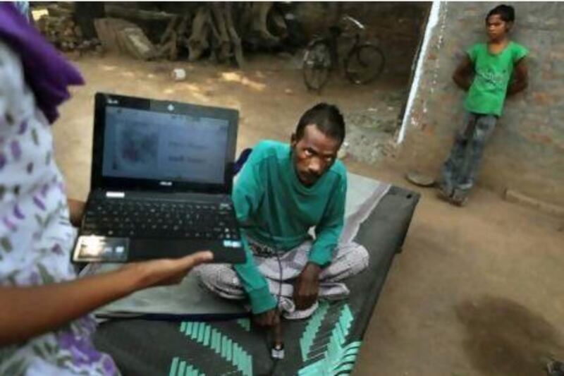 Tuberculosis patient Kallu, 36, who also suffers from HIV, gives his fingerprint  to counsellor Shammo Khan as part of a programme that tracks every dose of medicine he receives.