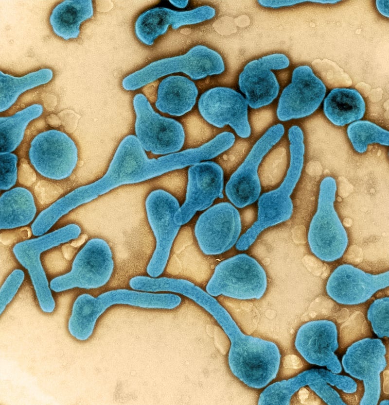 A colourised transmission electron micrograph shows Marburg virus particles in blue. BSIP SA / Alamy
