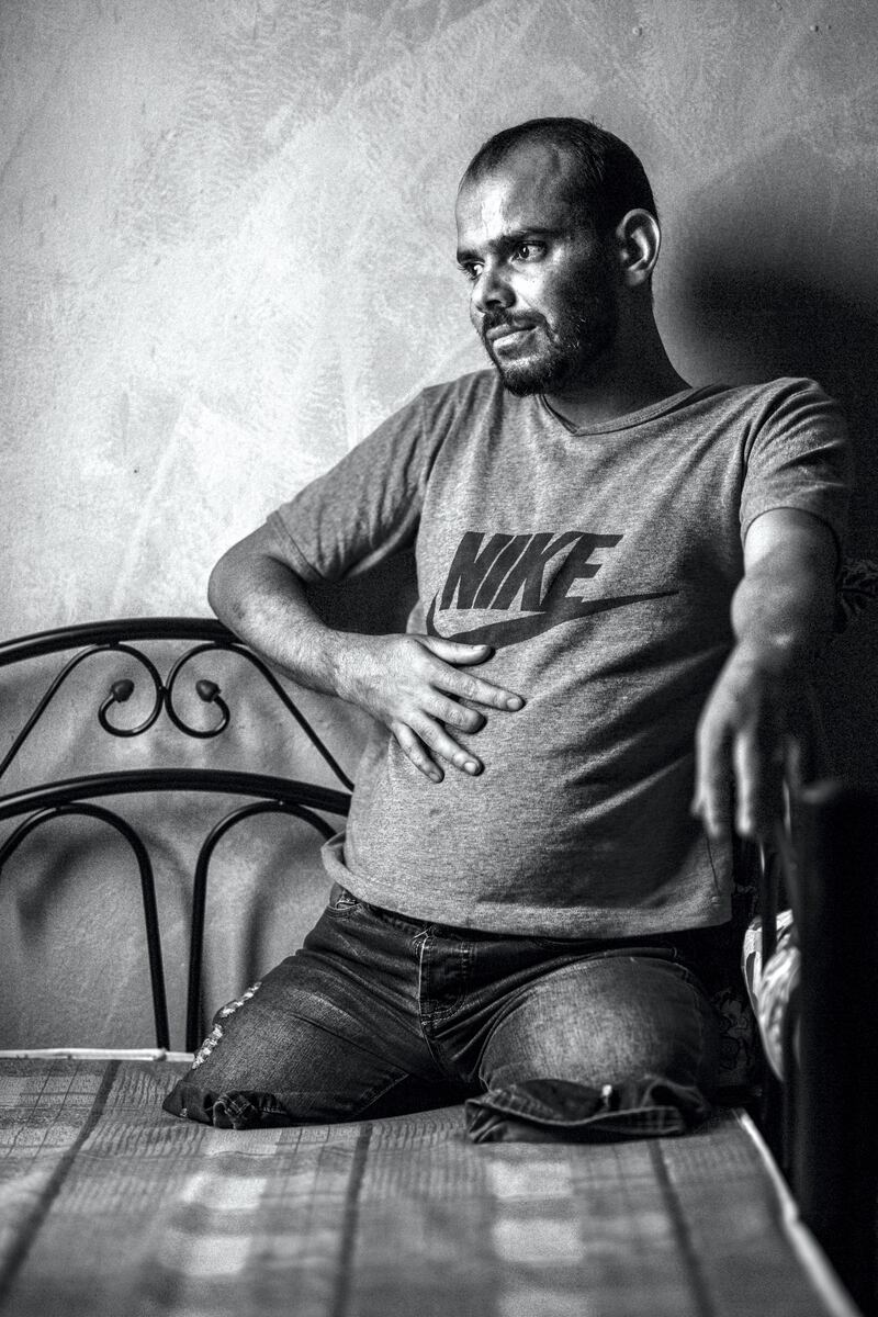 "The last thing I remember was being in my car in Aden,” says Qatada. “When I woke up, I could feel pain all over my body. I couldn’t use my hands, my right arm was fractured, my left was disabled and both my legs had been amputated." Alessio Mamo / MSF