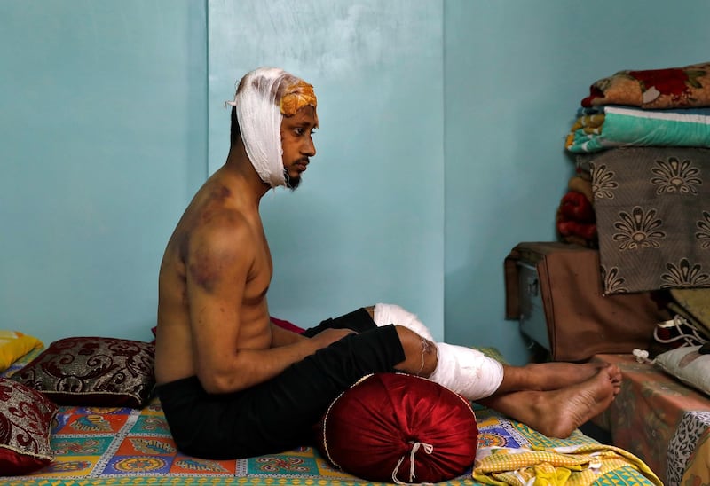 Mohammad Zubair, 37, who is Muslim and was injured after being beaten by a group of men  during protests sparked by a new citizenship law.  Reuters