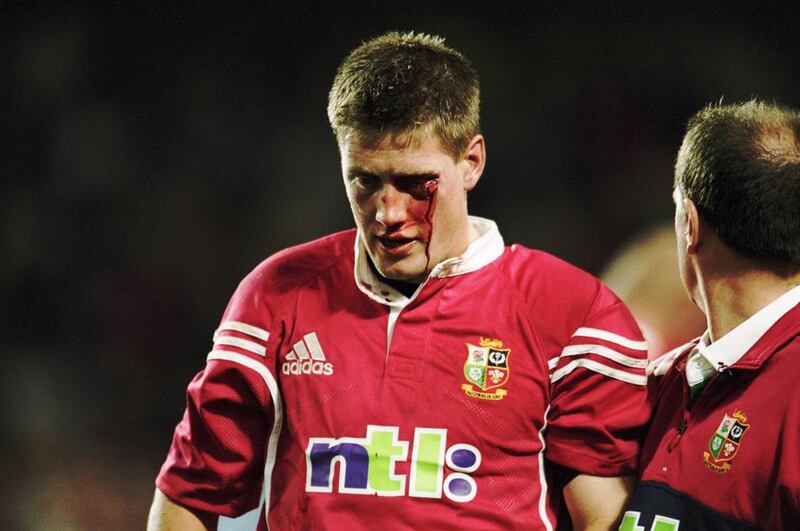 In this file photo from June 23, 2001 Ronan O'Gara, the British & Irish Lions fly-half, leaves the field bleeding after an assault by Duncan McRae of the NSW Waratahs during a tour match at Sydney Football Stadium in Sydney, Australia. Dave Rogers / Getty Images