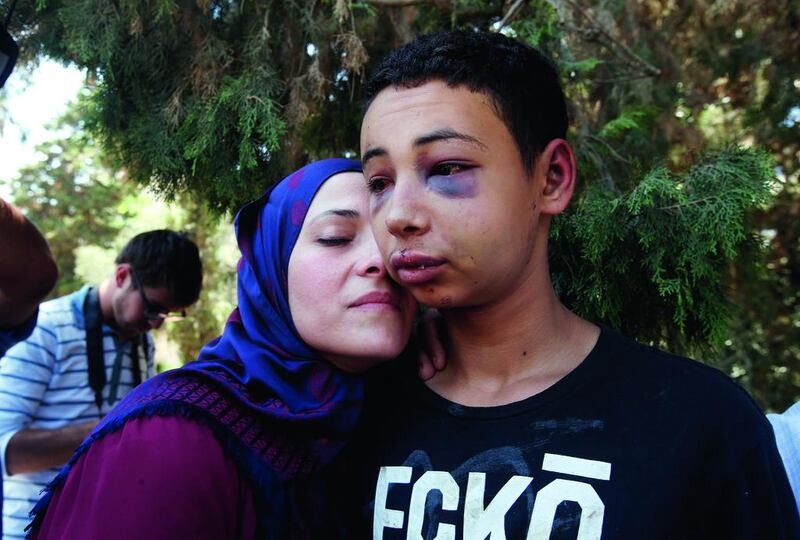 Tariq Khdeir is greeted by his mother after being released from jail in Jerusalem on July 6. The picture was taken outside the courthouse following the release of Khdeir, a 15-year-old American of Palestinian descent, whose beating by Israeli police during a violent protest in East Jerusalem drew US concern. Ronen Zvulun / Reuters