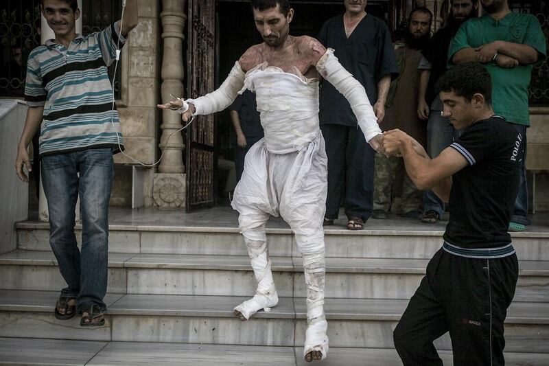 A Syrian man with more than half of his body burnt from an airstrike leaves a field hospital to return home in Idlib province, northern Syria. AP



