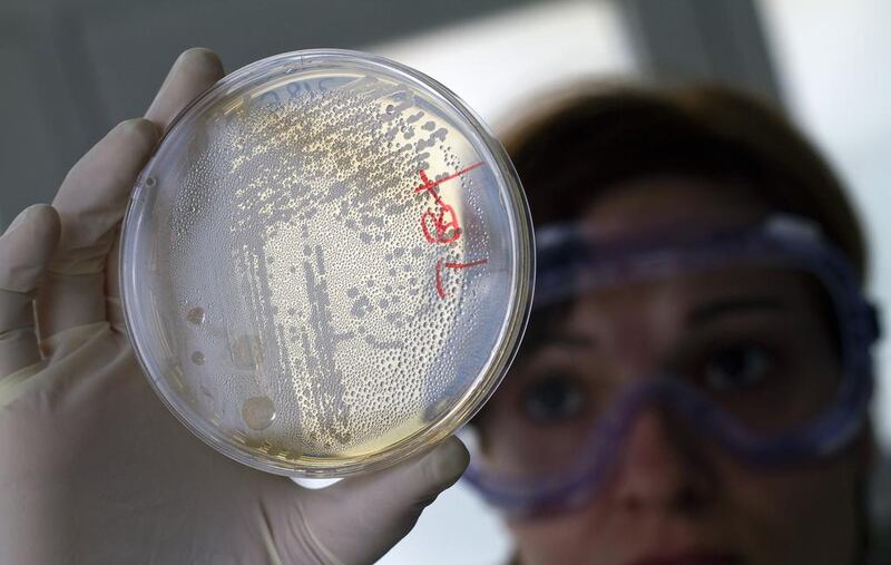 Examining E. coli after an outbreak in Spain in 2011. Francisco Bonilla / Reuters