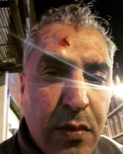 The presenter shared images of his injuries to social media. Maajid Nawaz/ Twitter