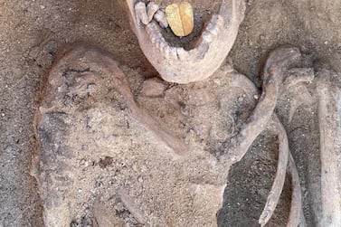 A 2,000-year-old mummy with a gold foil amulet in the shape of a tongue in its mouth, found in Taposiris Magna temple, in the Egyptian city of Alexandria. EPA