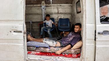 TOPSHOT - A man with an injured leg sits inside a minibus in the northern Gaza Strip on May 11, 2024 amid the ongoing conflict in the Palestinian territory between Israel and Hamas.  (Photo by AFP)