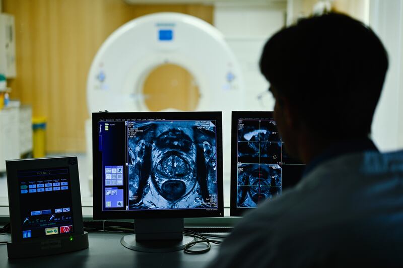 Medics view a cross-sectional image of a prostate on the monitor. Getty Images