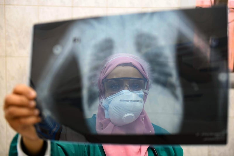 (FILES) In this file photo taken on April 19, 2020, an Egyptian doctor wearing two protective masks checks a patient's lung X-ray at the infectious diseases unit of the Imbaba hospital in the capital Cairo, during the COVID-19 coronavirus pandemic crisis.   Four months after Egypt reported its first coronavirus case, experts say the health system is approaching a "critical threshold" in its capacity to tackle the disease. The Arab world's most populous country of 100 million inhabitants has so far declared JUST OVER 12,000 coronavirus cases and 600 fatalities from the COVID-19 respiratory disease. / AFP / Ahmed HASAN
