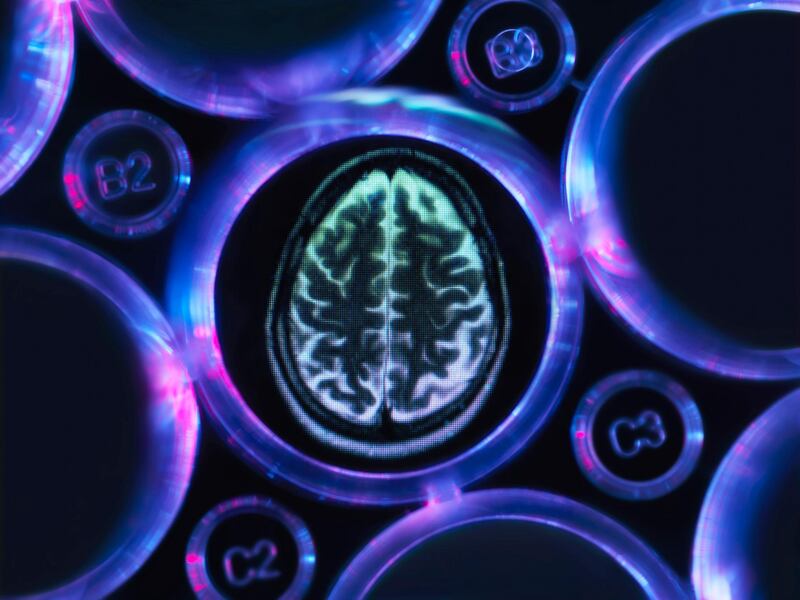 Alzheimers and dementia research, a brain scan in multi well tray used for research experiments in laboratory. Getty Images