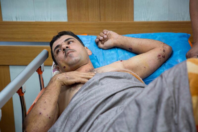 An injured staff member of Iraqi oil ministry's Drilling Company lies on a bed at a hospital in Basra. AFP