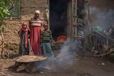 Kasech Fantu is a vegetable merchant who lives in Ethiopia with her two children. She suffers from an advanced stage of lymphatic filariasis that causes the limbs to swell, resulting in severe mobility issues and potentially permanent disability. Photo: Reach Campaign