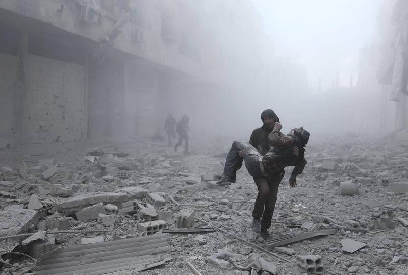 TOPSHOT - A wounded man is carried following an air strike on the rebel-held besieged town of Arbin, in the eastern Ghouta region on the outskirts of the capital Damascus on January 2, 2018.  / AFP PHOTO / ABDULMONAM EASSA