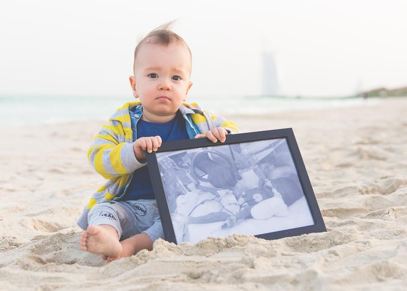 Brooklyn was born at 27 weeks. Courtesy JewelSeddon Photography