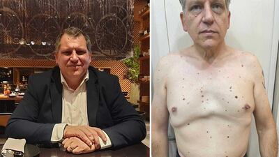 Pictures of Robert Pether before and during his detention in Baghdad. Photo: Supplied by Desree Pether