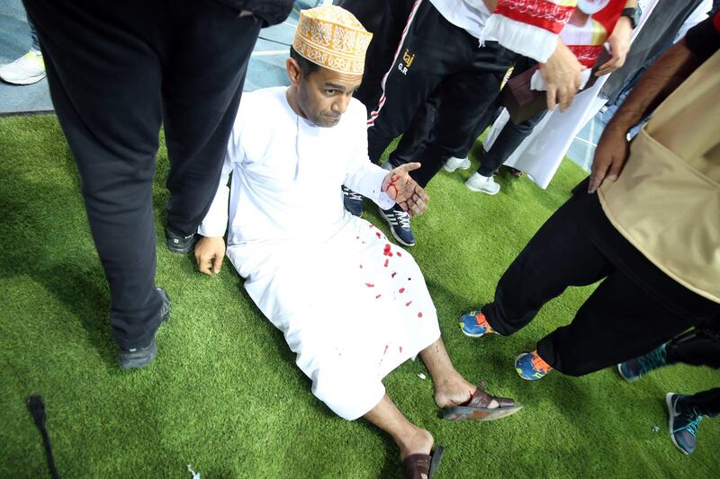 A wounded fan awaits treatment after a glass barrier broke at the end of the Gulf Cup of Nations 2017 final football match between Oman and the UAE at the Sheikh Jaber al-Ahmad Stadium in Kuwait City on January 5, 2018. Yasser Al-Zayyat / AFP