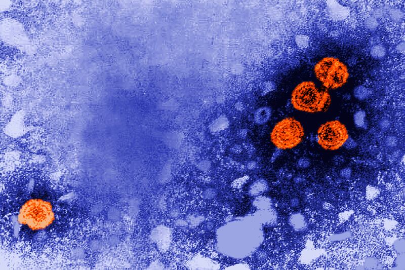 This 1981 electron microscope image made available by the US Centres for Disease Control and Prevention shows hepatitis B virus particles, indicated in orange. The round virions, which measure 42nm in diameter, are known as Dane particles. AP