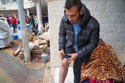 Akram Jundiye, a Gazan stranded in Ramallah, rolls up his trousers to reveal a bruise he said was caused by Israeli soldiers. Willy Lowry / The National