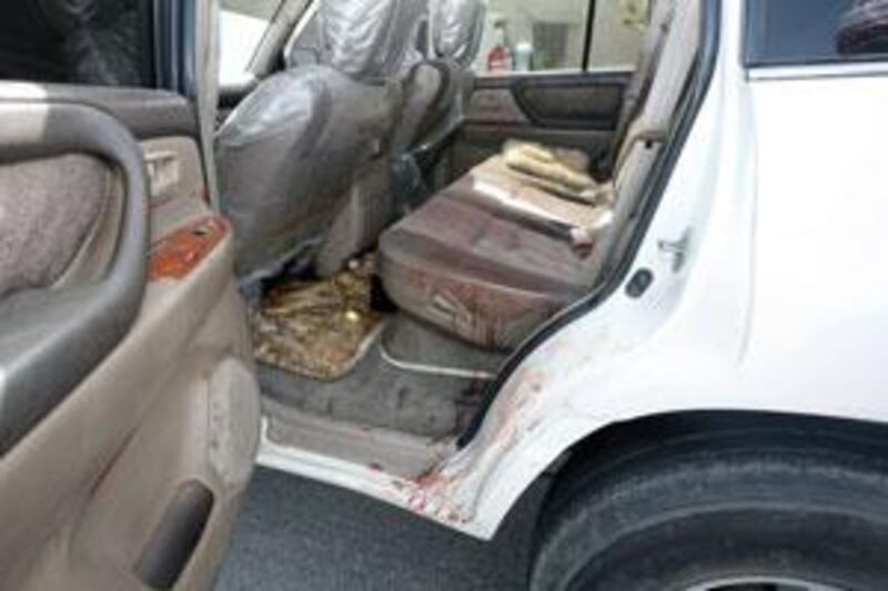 Bloodstains in the car that was used to drive Ali Mohammed Hassan to hospital.