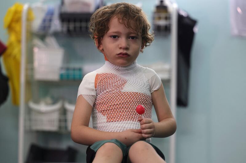 Yasser Khila, 4, is comforted with a lollipop after a dressing was applied to his wounds from spilt hot stew, at a clinic in Gaza city. The harsh living conditions and unsafe energy supplies in the Palestinian enclave blockaded by Israel since 2007 are contributing to the thousands of burns requiring treatment there each year.  AFP