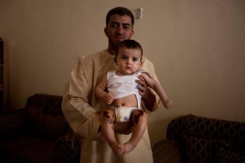 June 12, 2011, Al Ain, UAE:

Civil Defense Authorities released their version of what happened in Al Ain's tragic fire last week which claimed at least 2 lives of the Shaheen family.

Seen here with burn wounds is Farif Shaheen, being held by his father, Ahmed Khalil Shaheen. Mr. Shaheen says that at least this child was helped by civil defences.  He lost his wife and son in the fire.

Lee Hoagland/The National