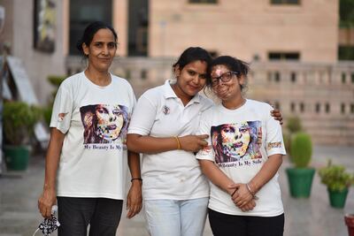 Anshu Rajput, far right, at Sheroes Hangout with Asma and Gudiya. Photo: Sheroes Hangout