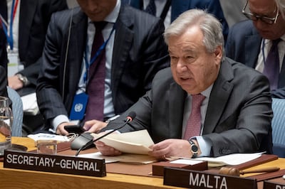 UN Secretary General Antonio Guterres said the new food report was a 'roll call of human failings'. AP 