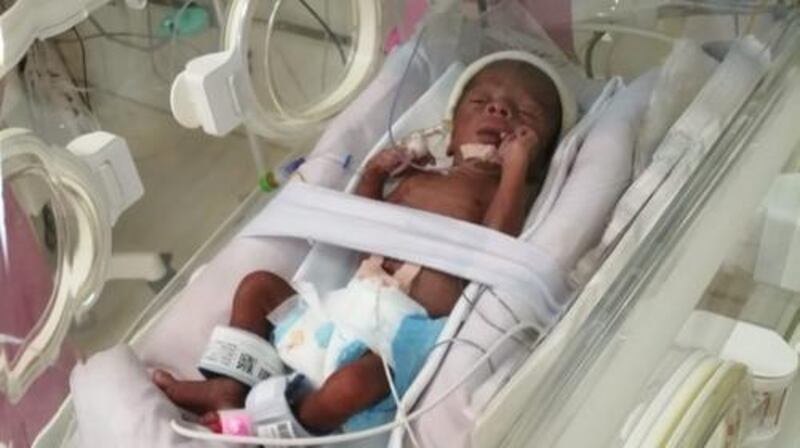 Four Nigerian babies born month prematurely in Dubai are recovering at Latifah Women and Children’s Hospital in Dubai. Courtesy: Abdulkareem family 