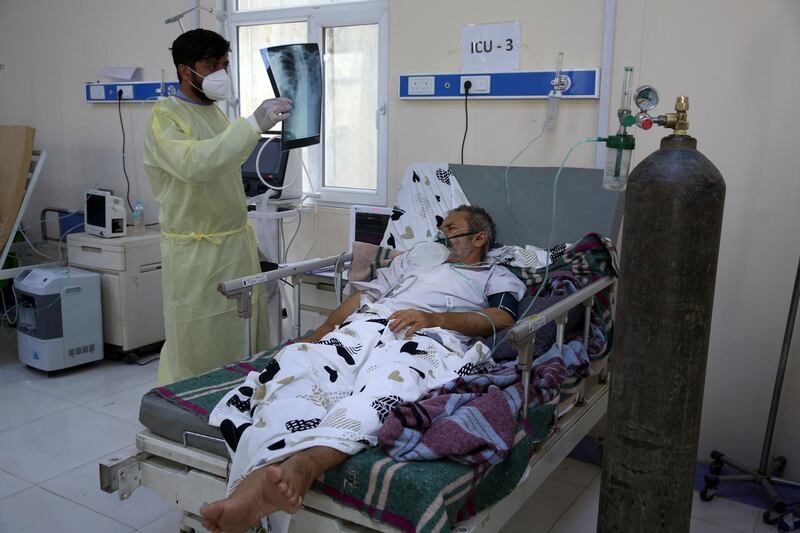 A patient is connected to oxygen tank in the Intensive Care Unit ward for COVID-19 patients at the Afghan-Japan Communicable Disease Hospital in Kabul, Afghanistan, Tuesday June 30, 2020. (AP Photo/Rahmat Gul)