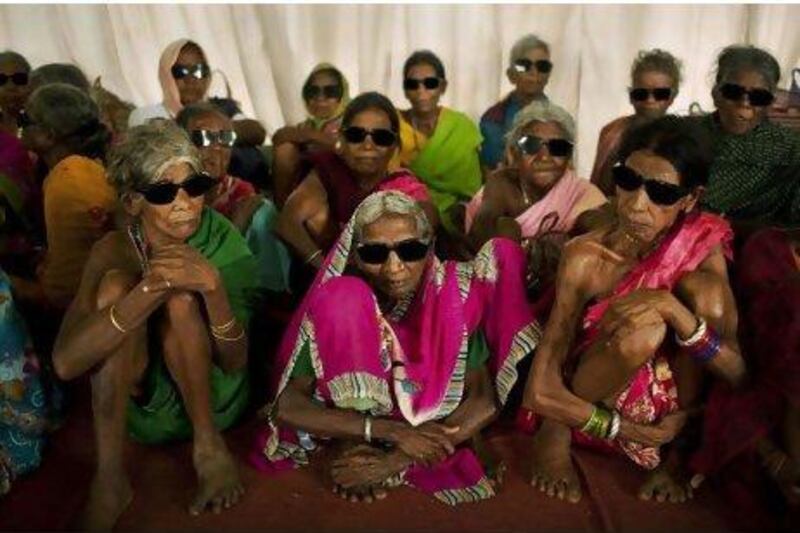 Indian tribal villagers wait to be discharged in a recovery area after undergoing cataract surgeries in Jagdalpur conducted by doctors from the Lifeline Express, a five-coach train with specialist doctors and operating rooms. Kevin Frayer / AP Photo